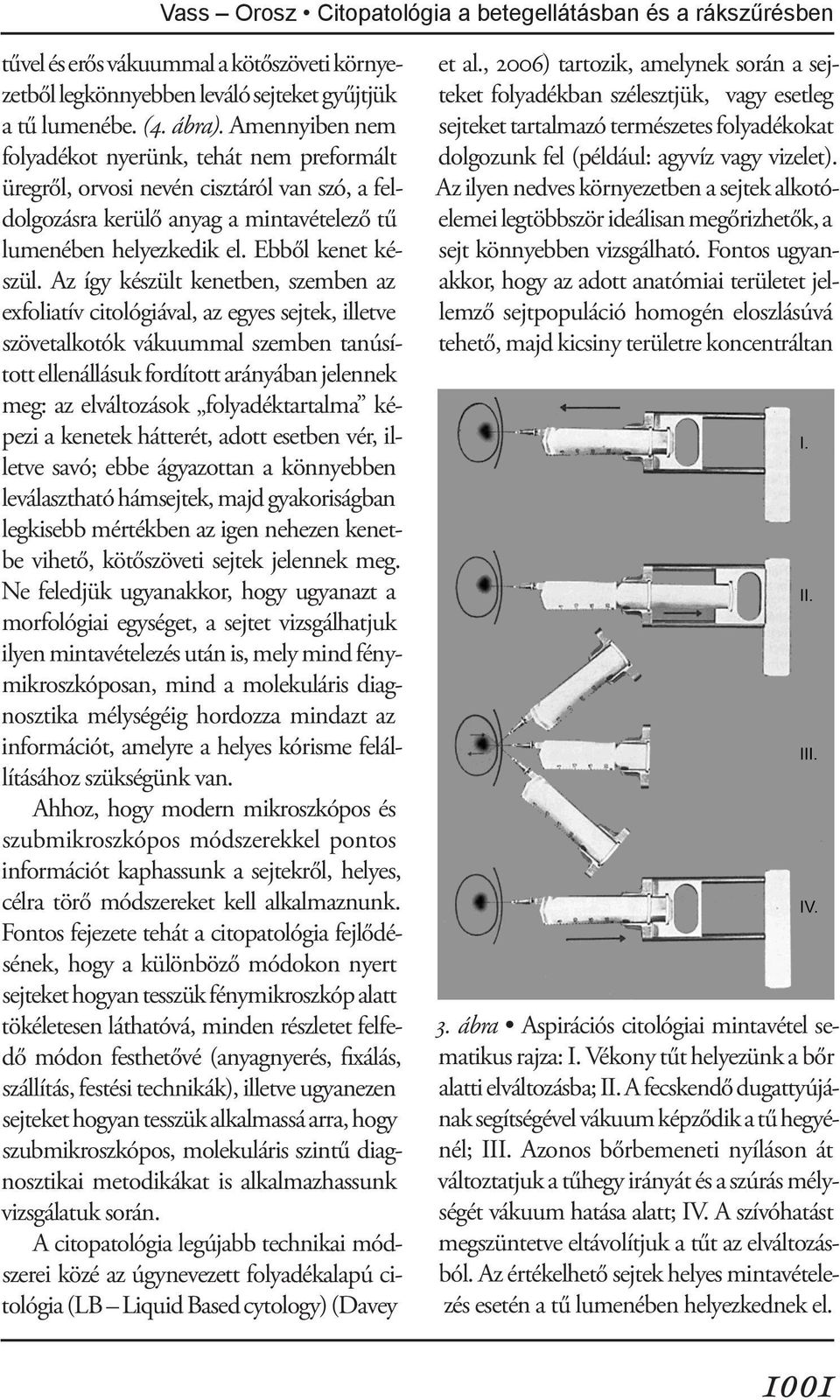 Az így készült kenetben, szemben az exfoliatív citológiával, az egyes sejtek, illetve szövetalkotók vákuummal szemben tanúsított ellenállásuk fordított arányában jelennek meg: az elváltozások