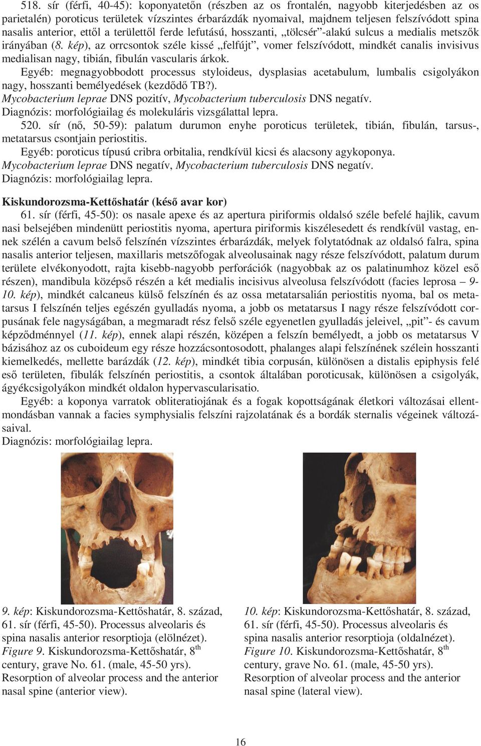 kép), az orrcsontok széle kissé felfújt, vomer felszívódott, mindkét canalis invisivus medialisan nagy, tibián, fibulán vascularis árkok.