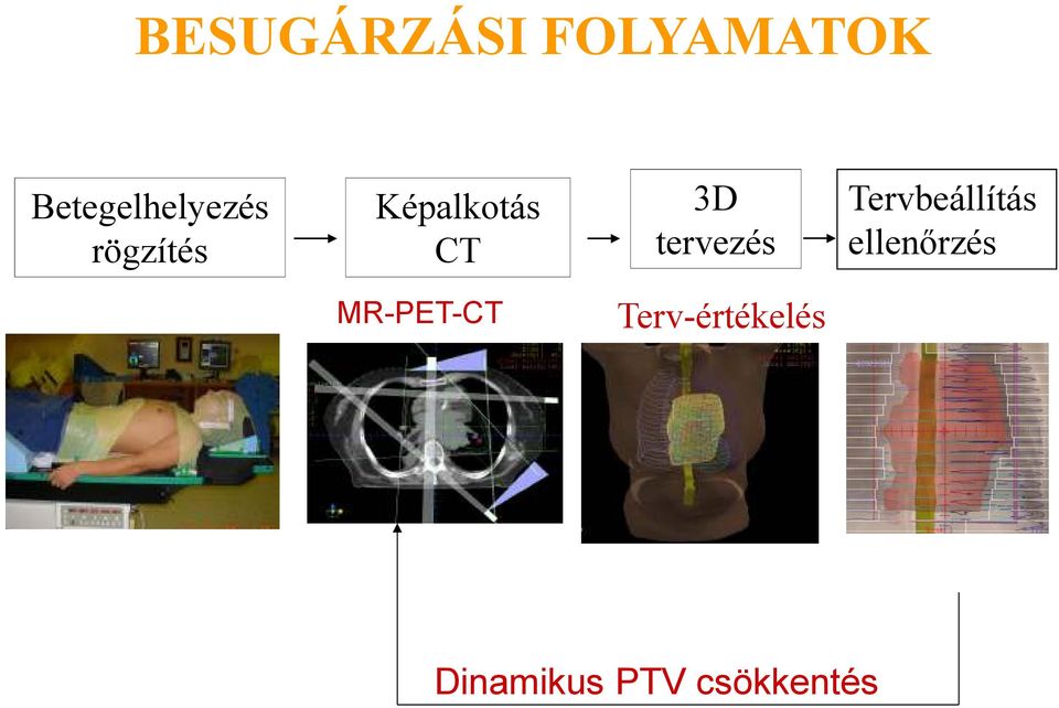 CT 3D tervezés Tervbeállítás