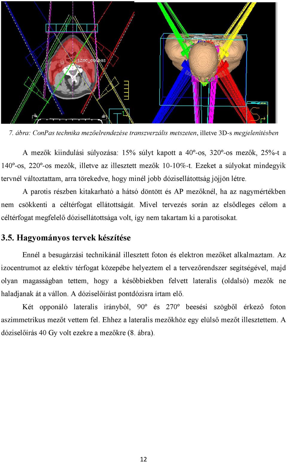 A parotis részben kitakarható a hátsó döntött és AP mezőknél, ha az nagymértékben nem csökkenti a céltérfogat ellátottságát.