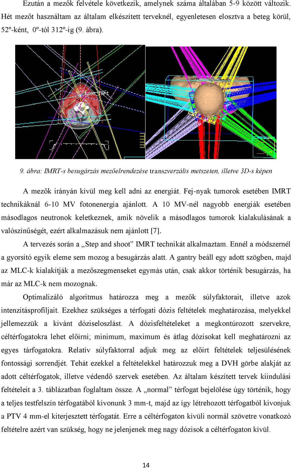 ábra: IMRT-s besugárzás mezőelrendezése transzverzális metszeten, illetve 3D-s képen A mezők irányán kívül meg kell adni az energiát.