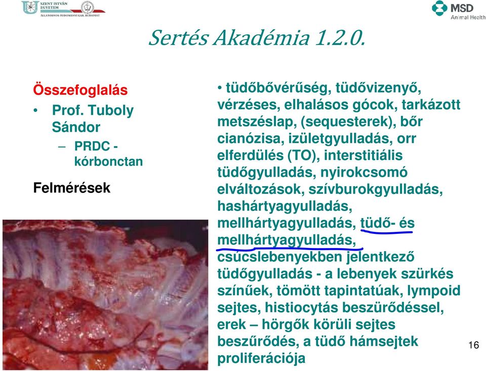 hashártyagyulladás, mellhártyagyulladás, tüdő- és mellhártyagyulladás, csúcslebenyekben jelentkező tüdőgyulladás - a lebenyek szürkés