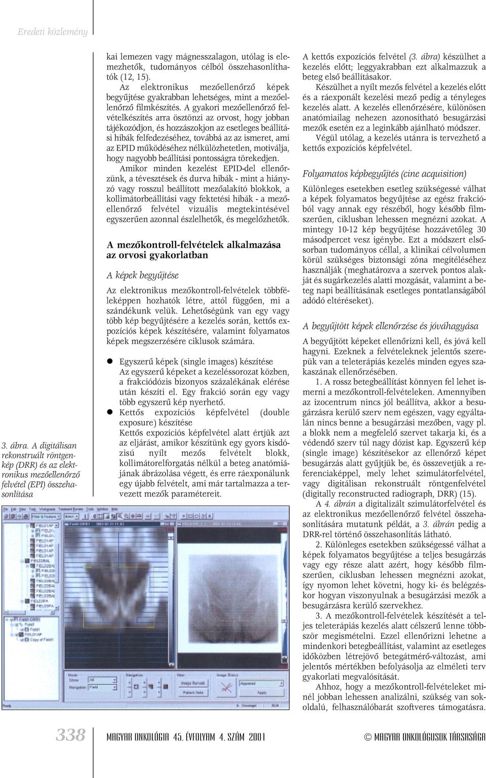 összehasonlíthatók (12, 15). Az elektronikus mezôellenôrzô képek begyûjtése gyakrabban lehetséges, mint a mezôellenôrzô filmkészítés.