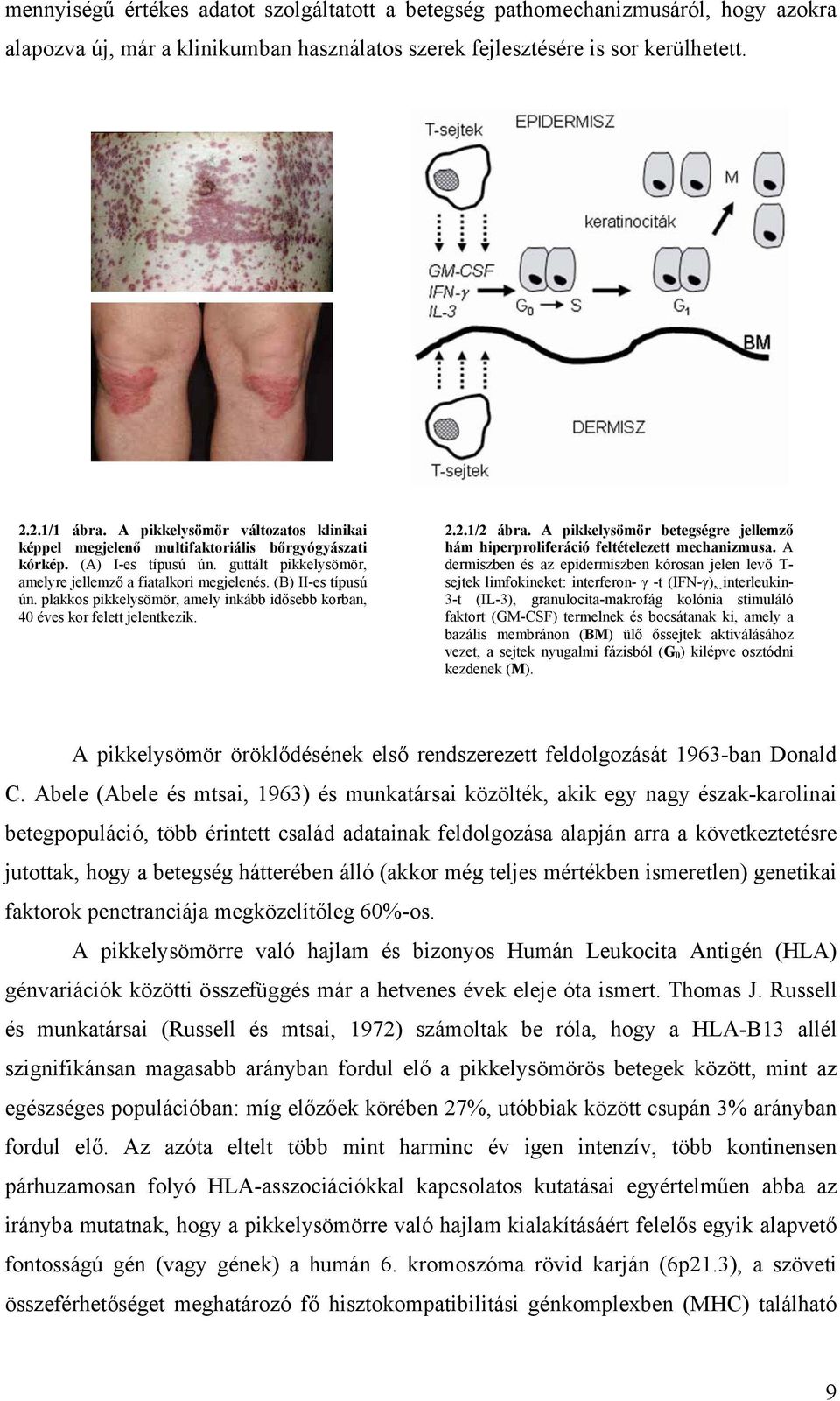 plakkos pikkelysömör, amely inkább idősebb korban, 40 éves kor felett jelentkezik. 2.2.1/2 ábra. A pikkelysömör betegségre jellemző hám hiperproliferáció feltételezett mechanizmusa.