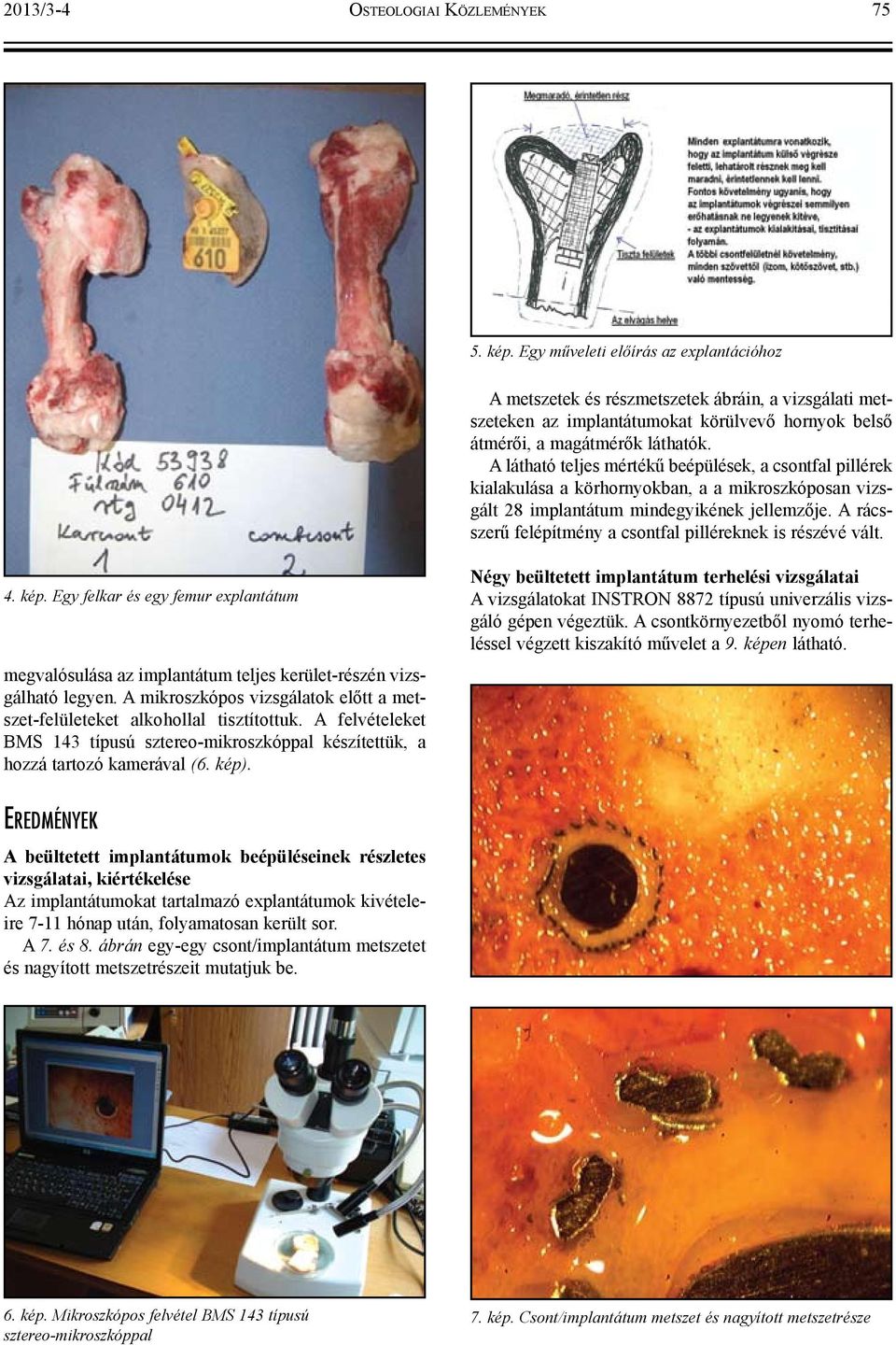 A látható teljes mértékű beépülések, a csontfal pillérek kialakulása a körhornyokban, a a mikroszkóposan vizsgált 28 implantátum mindegyikének jellemzője.