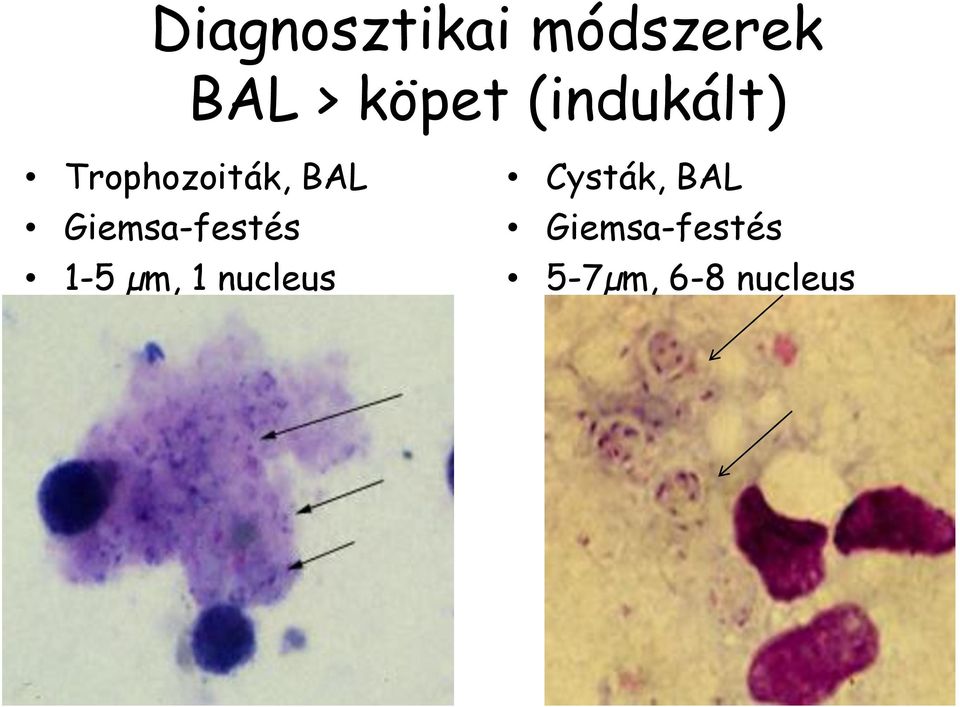 Giemsa-festés 1-5 µm, 1 nucleus