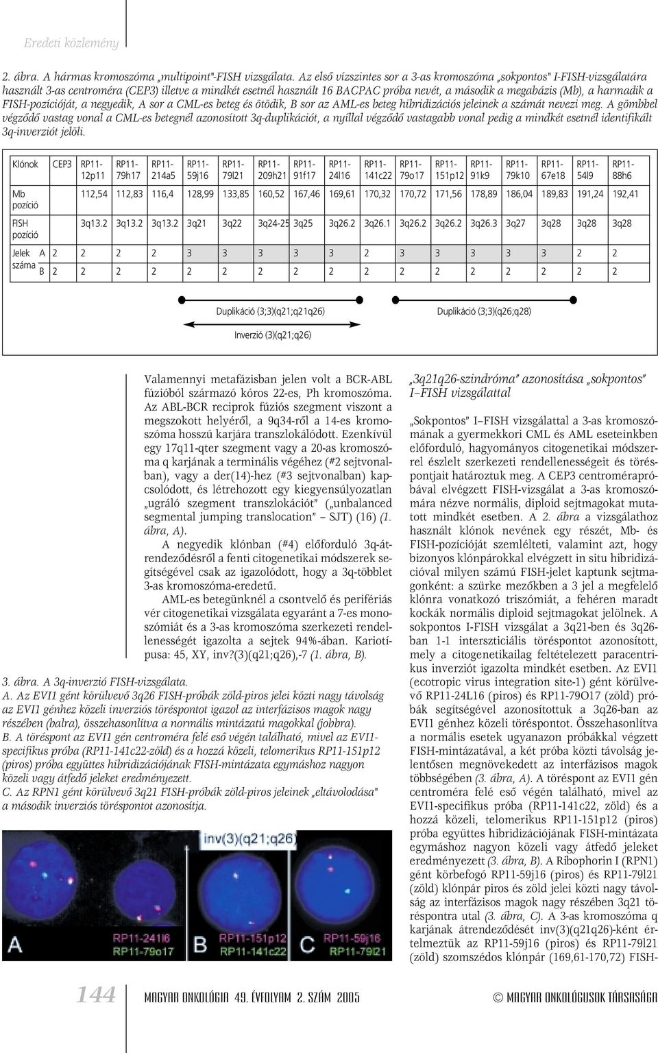 harmadik a FISH-pozícióját, a negyedik, A sor a CML-es beteg és ötödik, B sor az AML-es beteg hibridizációs jeleinek a számát nevezi meg.