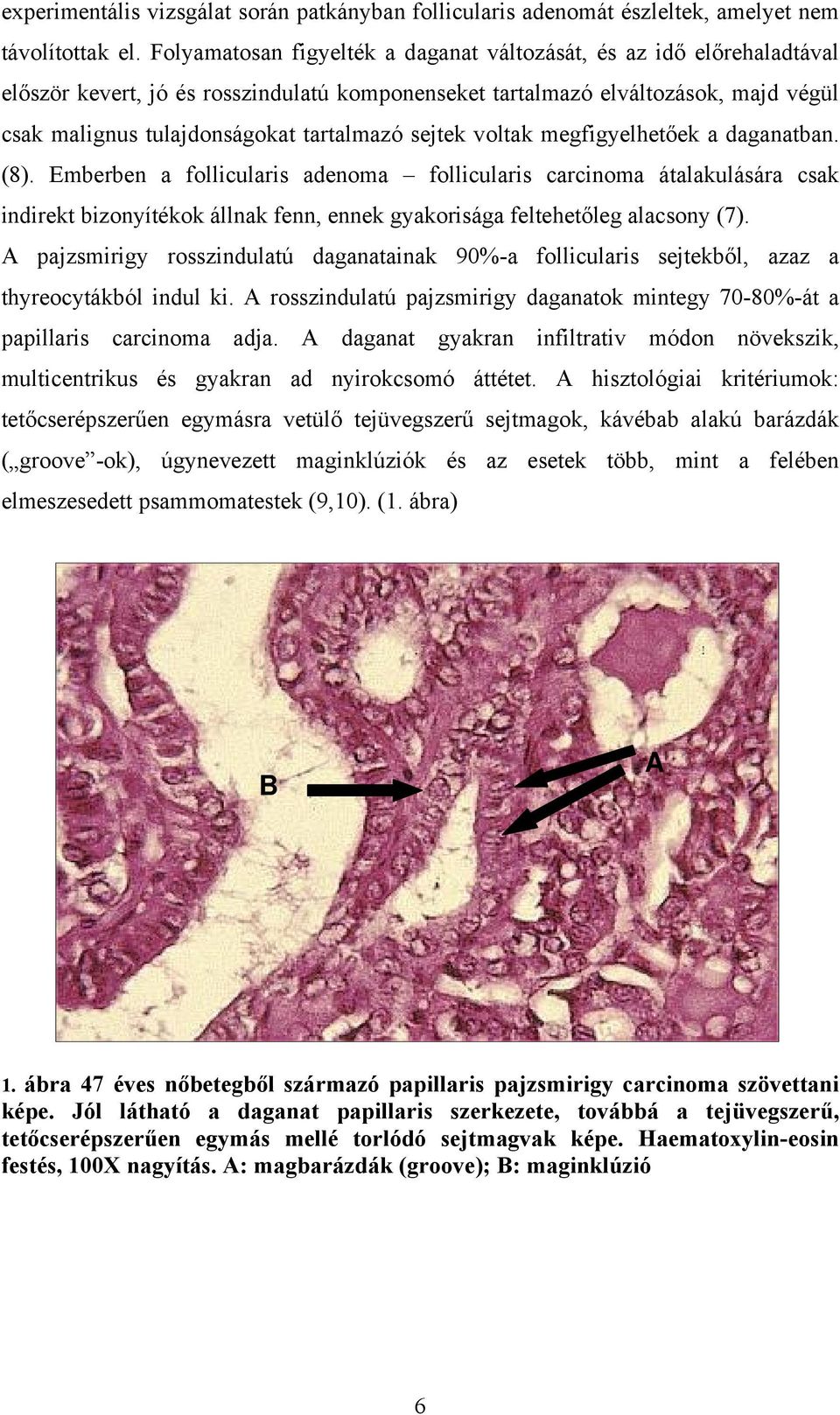 sejtek voltak megfigyelhetőek a daganatban. (8).