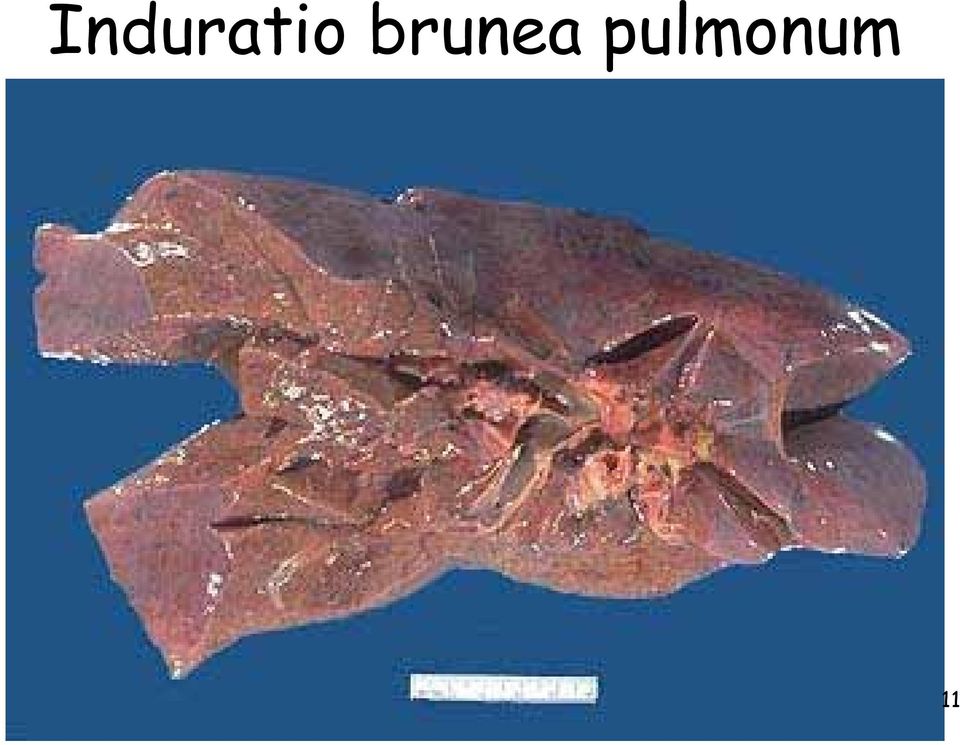 pulmonum