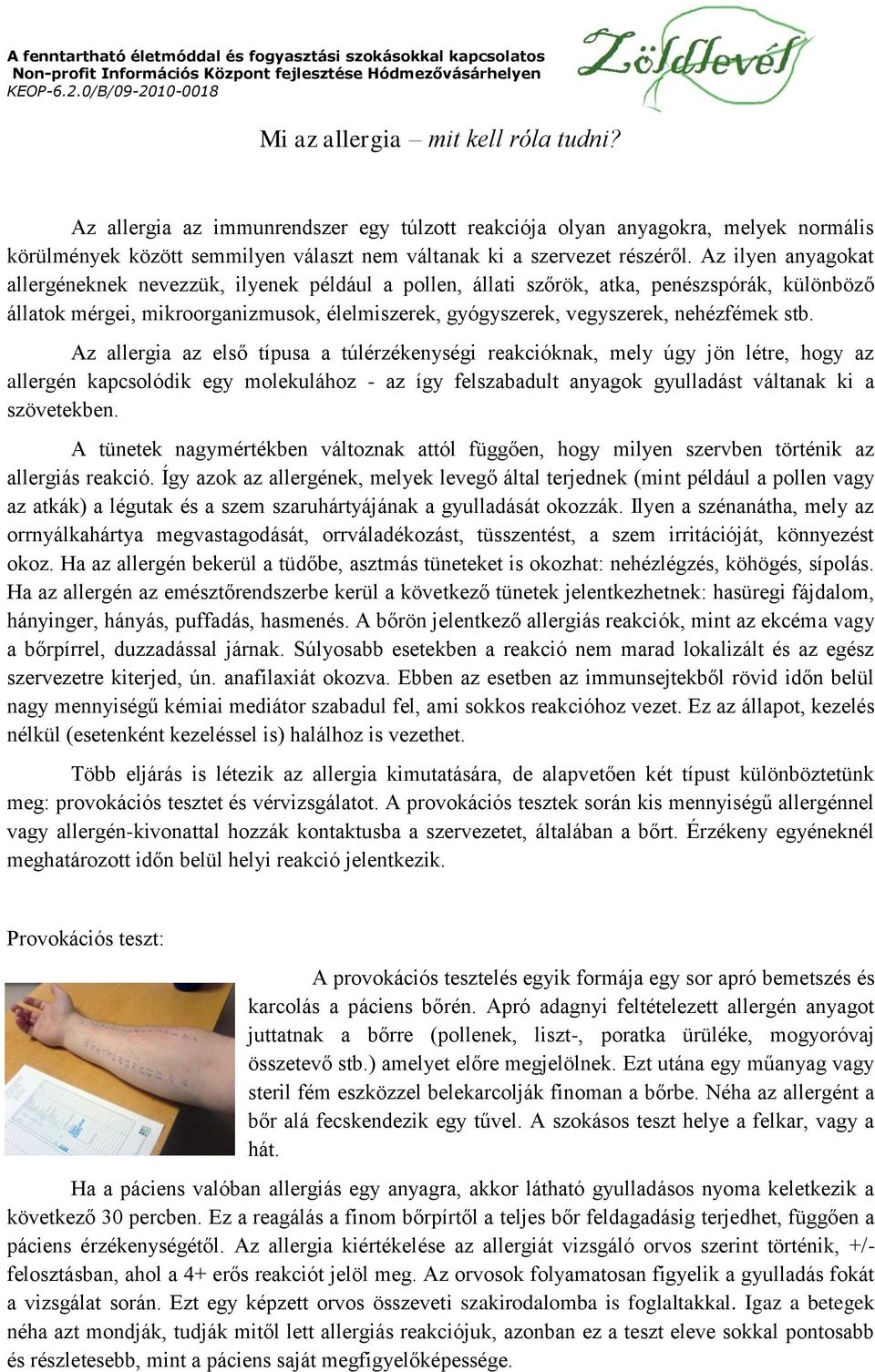 stb. Az allergia az első típusa a túlérzékenységi reakcióknak, mely úgy jön létre, hogy az allergén kapcsolódik egy molekulához - az így felszabadult anyagok gyulladást váltanak ki a szövetekben.