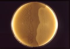 Clostridium tetani Clostridium