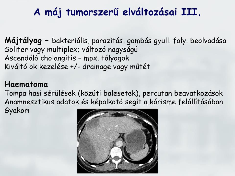 tályogok Kiváltó ok kezelése +/- drainage vagy műtét Haematoma Tompa hasi sérülések (közúti