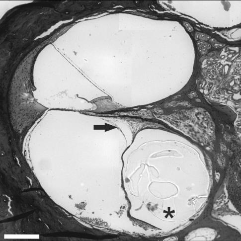 47. ábra. Halláskárosított tengerimalac bazális kanyarulatának átmetszeti képe implantátummal a scala tympaniban. Az implantátum és a lamina spiralis ossea között hegszövet látható (fekete nyíl). 48.