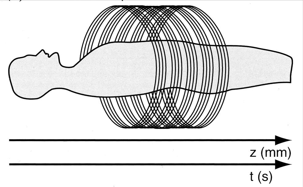 Multislice CT multislice (2-360 detektorsor) készülékek subsecundumos scan-idő ultrahang paradigma 3D alkalmazások