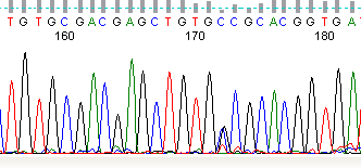 Eredmény, RET gén betegség-okozó mutáció T G G