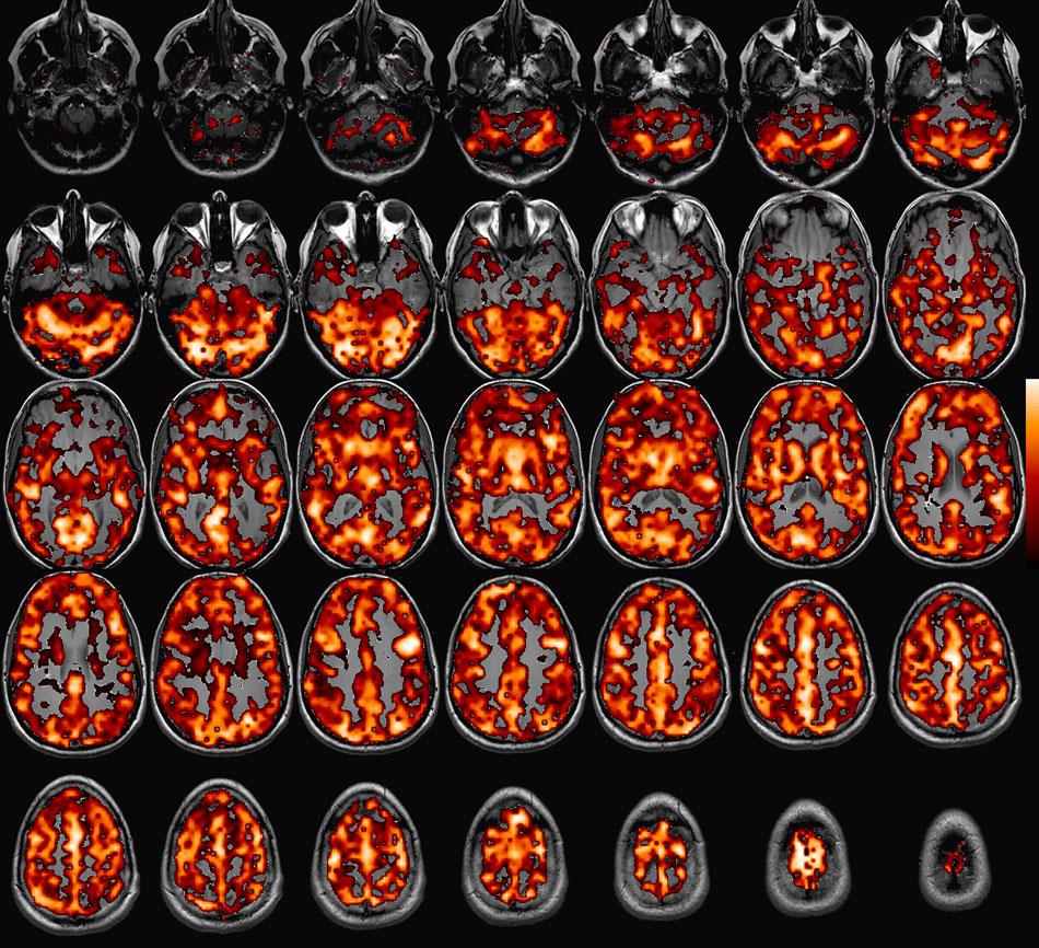 Az MRI-szkenner SZÁMÍTÓGÉPEK!