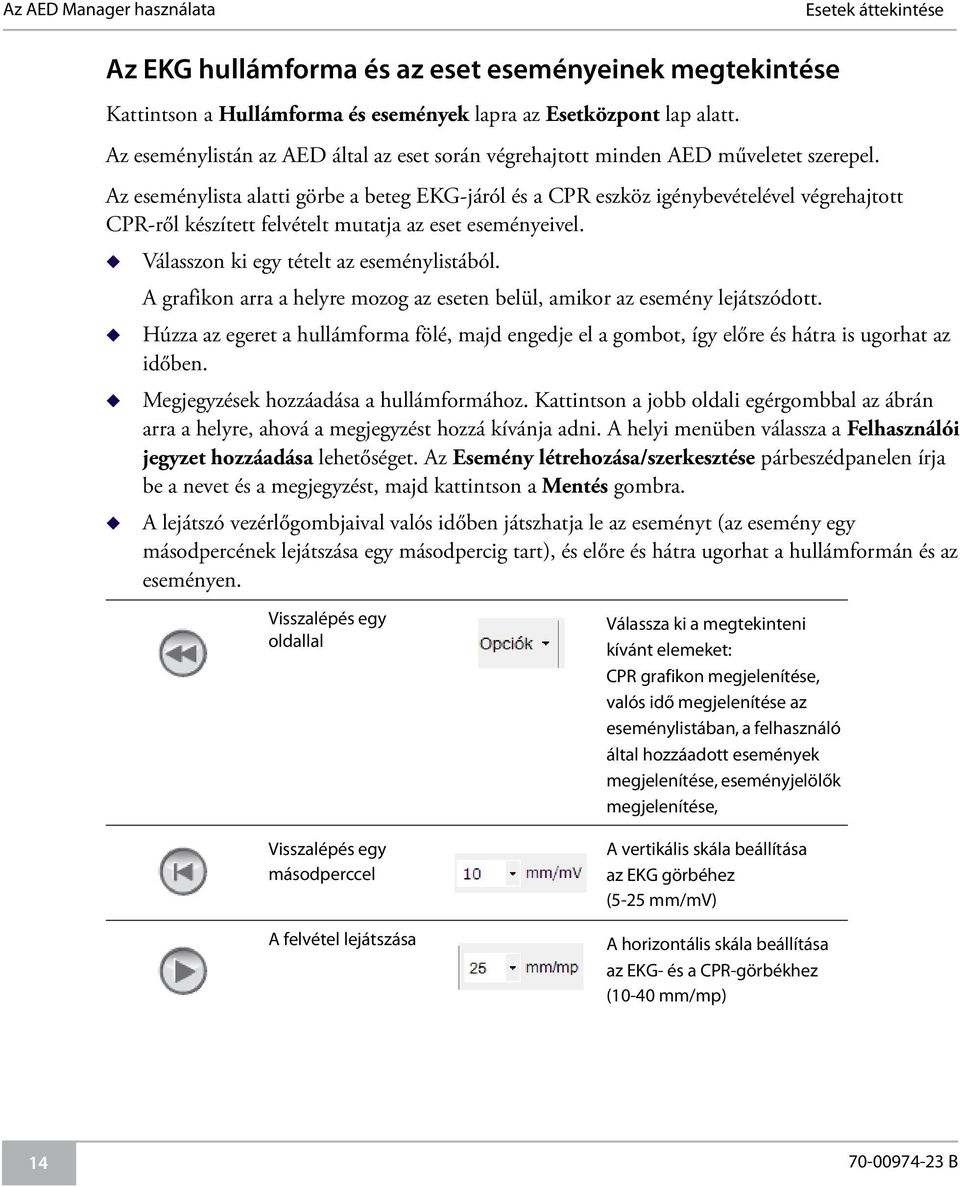 Az eseménylista alatti görbe a beteg EKG-járól és a CPR eszköz igénybevételével végrehajtott CPR-ről készített felvételt mutatja az eset eseményeivel. Válasszon ki egy tételt az eseménylistából.