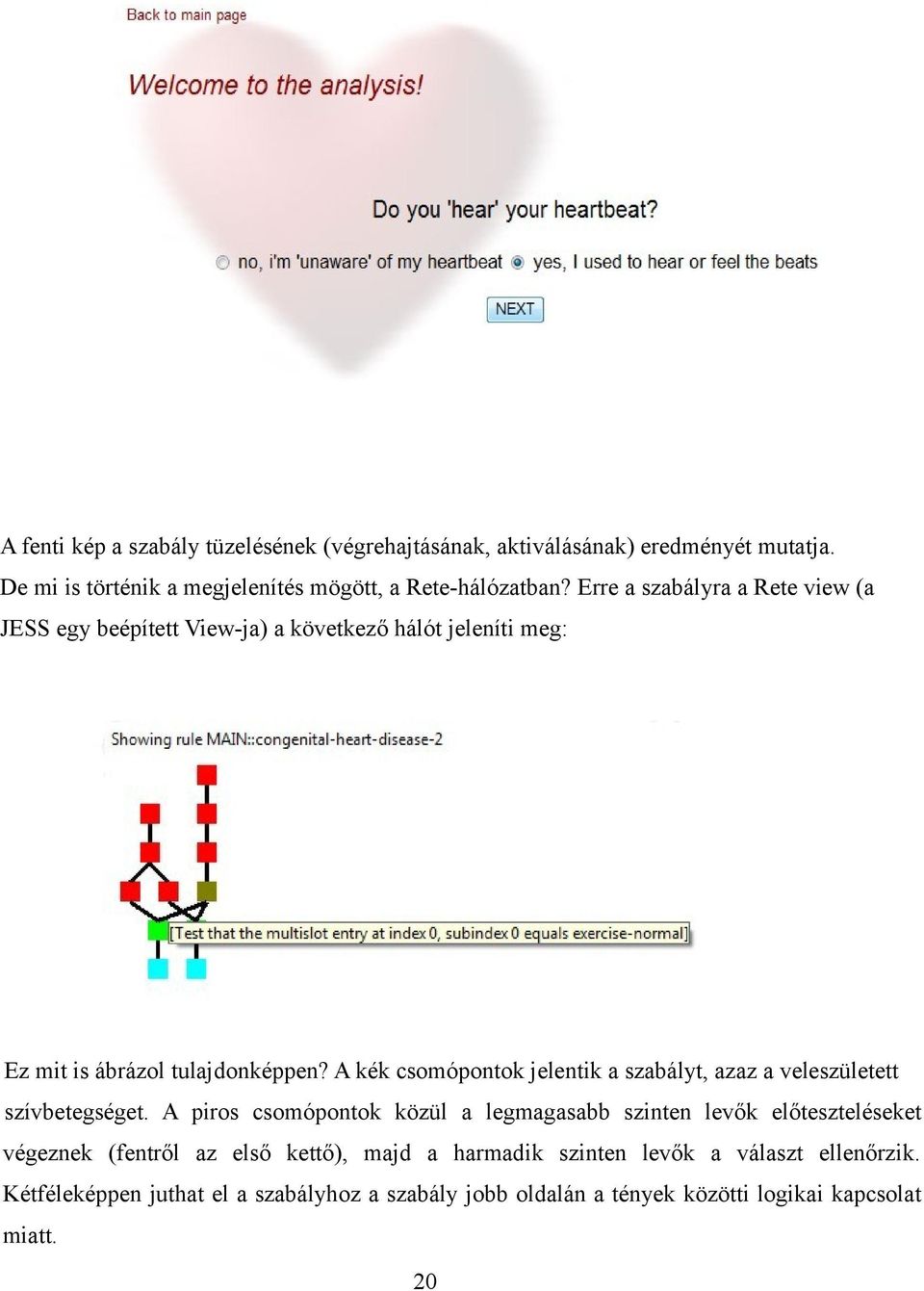 A kék csomópontok jelentik a szabályt, azaz a veleszületett szívbetegséget.