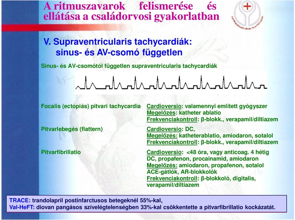 , verapamil/diltiazem Cardioversio: DC, Megelőzés: katheterablatio, amiodaron, sotalol Frekvenciakontroll: β-blokk., verapamil/diltiazem Cardioversio: <48 óra, vagy anticoag.