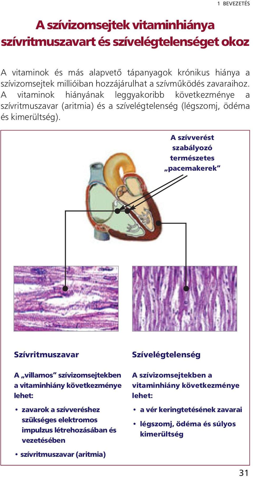 A szívverést szabályozó természetes pacemakerek Szívritmuszavar A villamos szívizomsejtekben a vitaminhiány következménye lehet: zavarok a szívveréshez szükséges elektromos