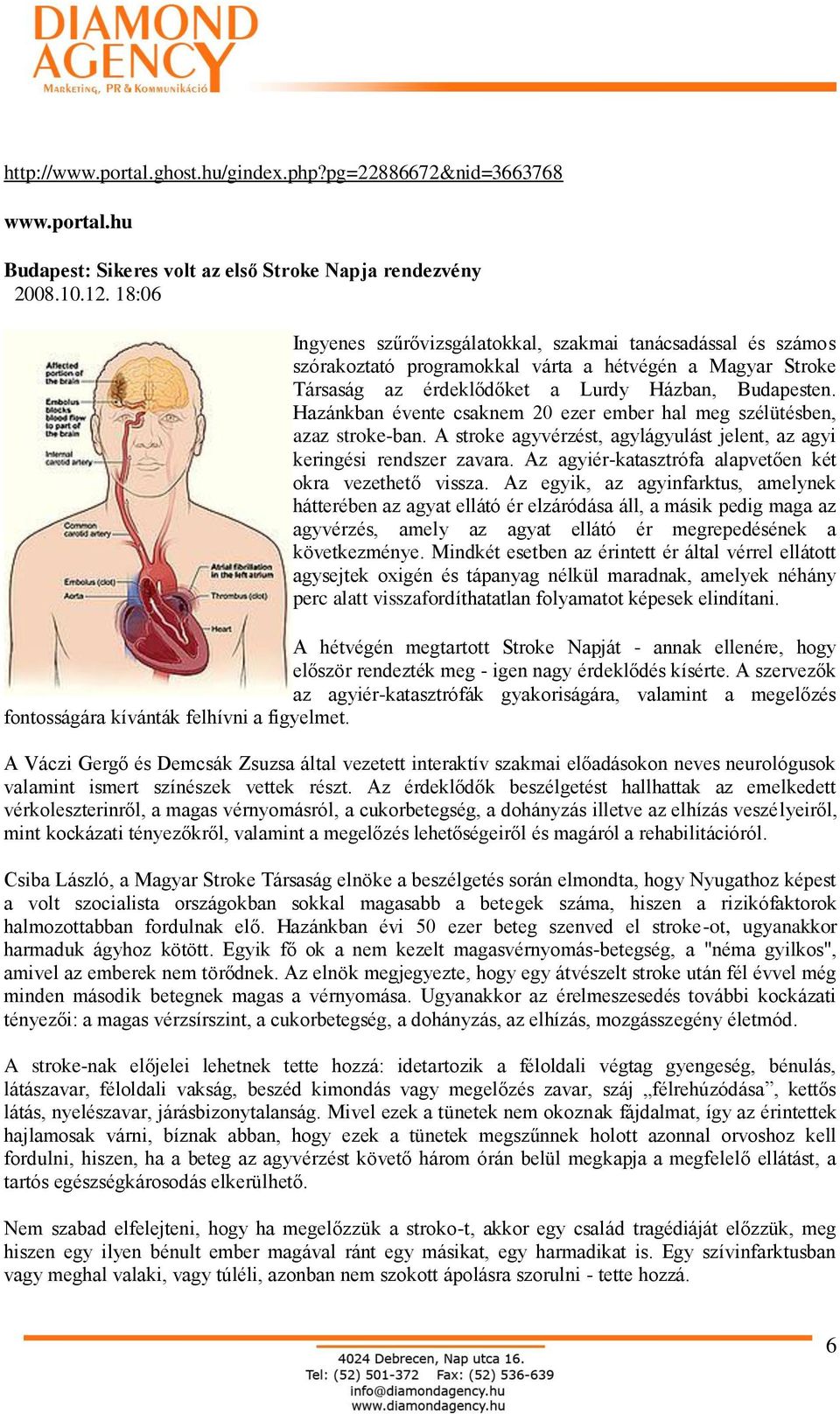 Hazánkban évente csaknem 20 ezer ember hal meg szélütésben, azaz stroke-ban. A stroke agyvérzést, agylágyulást jelent, az agyi keringési rendszer zavara.