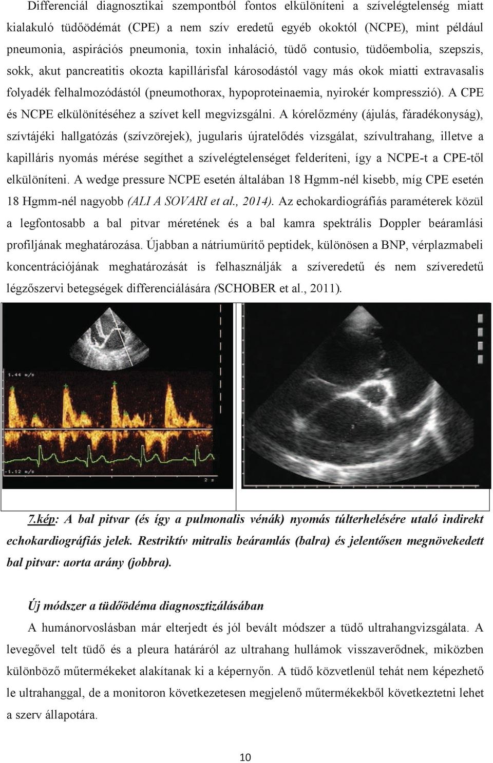 hypoproteinaemia, nyirokér kompresszió). A CPE és NCPE elkülönítéséhez a szívet kell megvizsgálni.