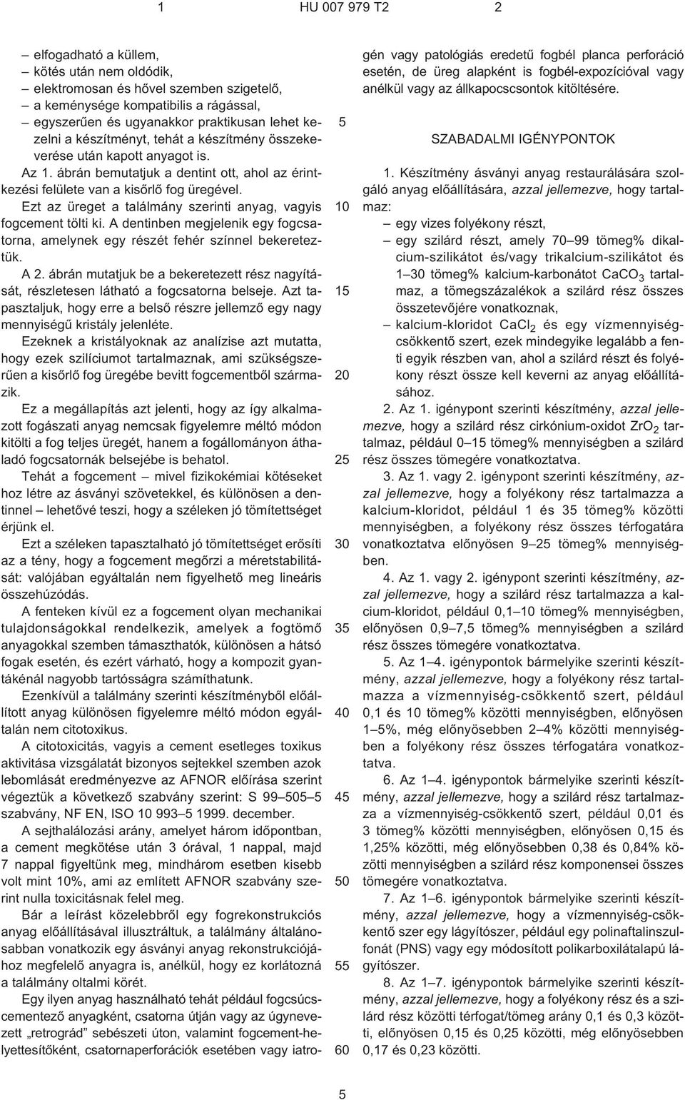 Ezt az üreget a találmány szerinti anyag, vagyis fogcement tölti ki. A dentinben megjelenik egy fogcsatorna, amelynek egy részét fehér színnel bekereteztük. A 2.