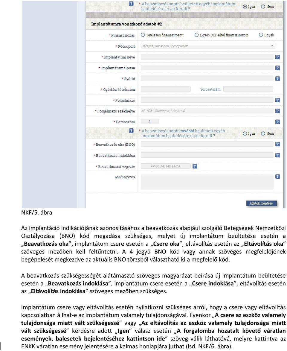 Beavatkozás oka, implantátum csere esetén a Csere oka, eltávolítás esetén az Eltávolítás oka szöveges mezőben kell feltűntetni.