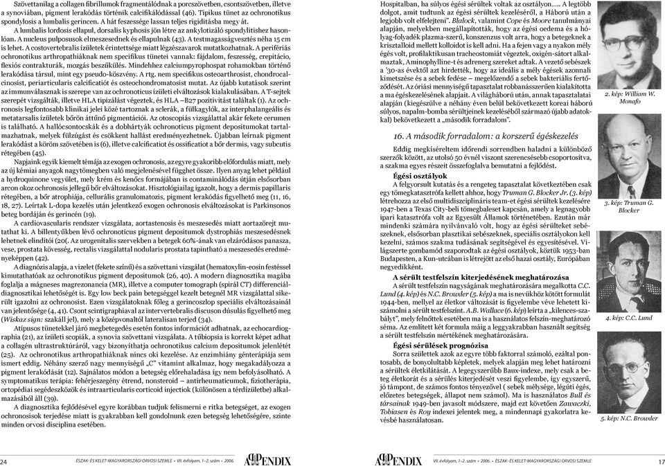 A lumbalis lordosis ellapul, dorsalis kyphosis jön létre az ankylotizáló spondylitishez hasonlóan. A nucleus pulposusok elmeszesednek és ellapulnak (43). A testmagasságvesztés néha 15 cm is lehet.