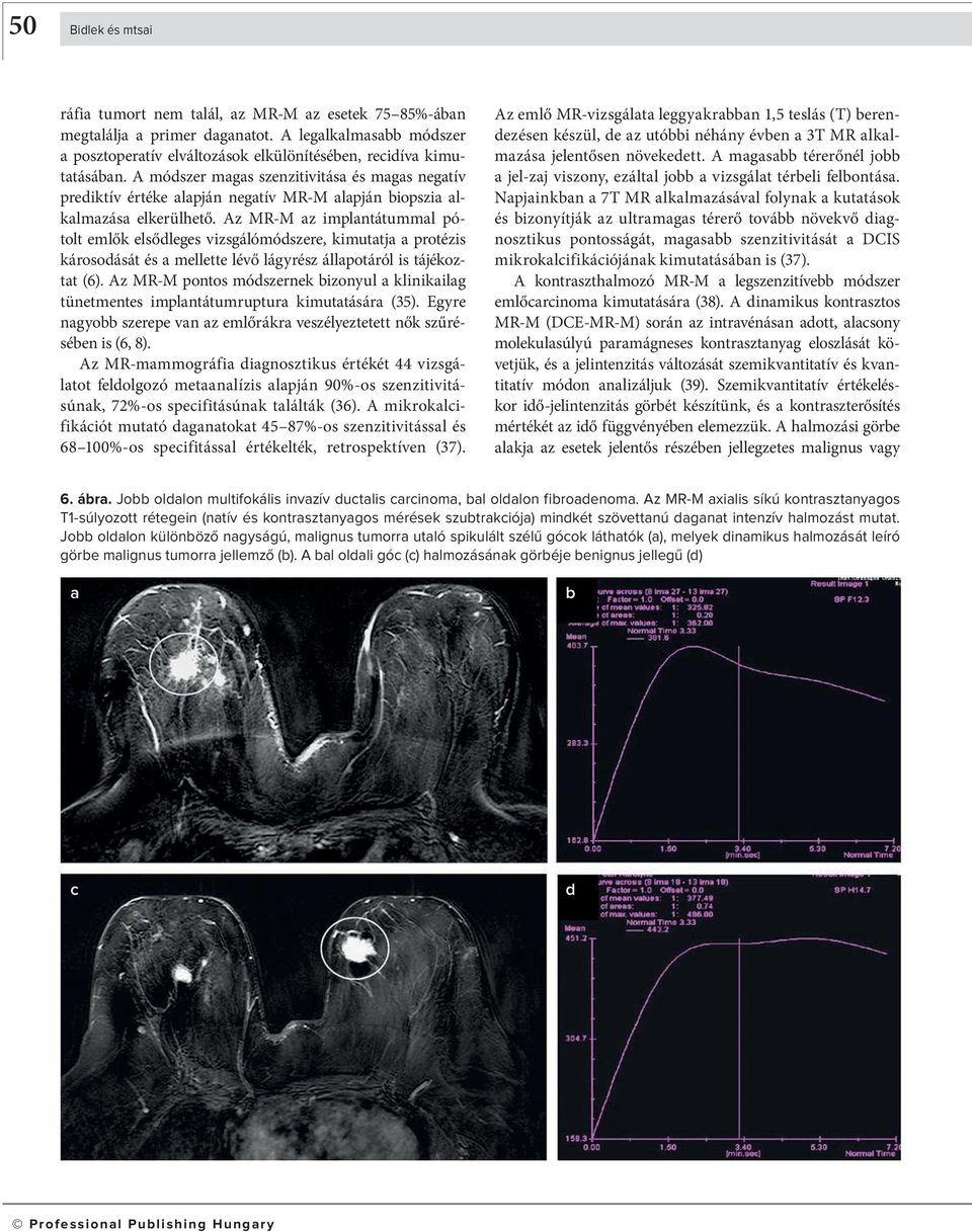 Az MR-M z implntátumml pótolt emlők elsődleges vizsgálómódszere, kimuttj protézis károsodását és mellette lévő lágyrész állpotáról is tájékoztt (6).