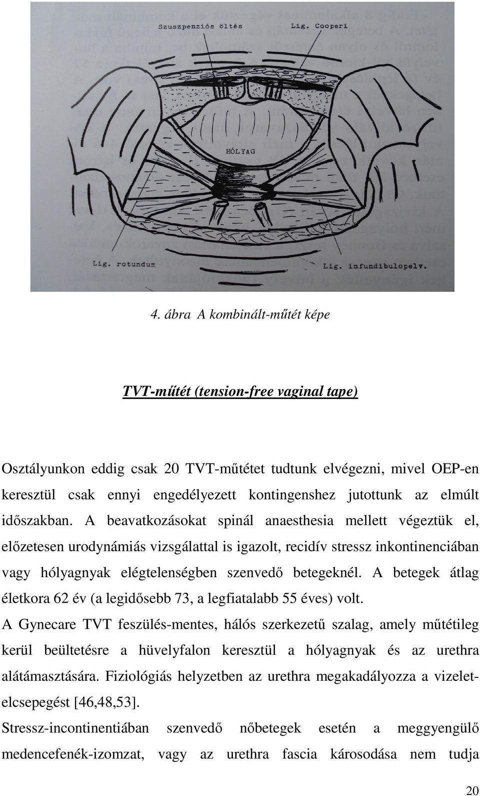 A beavatkozásokat spinál anaesthesia mellett végeztük el, előzetesen urodynámiás vizsgálattal is igazolt, recidív stressz inkontinenciában vagy hólyagnyak elégtelenségben szenvedő betegeknél.