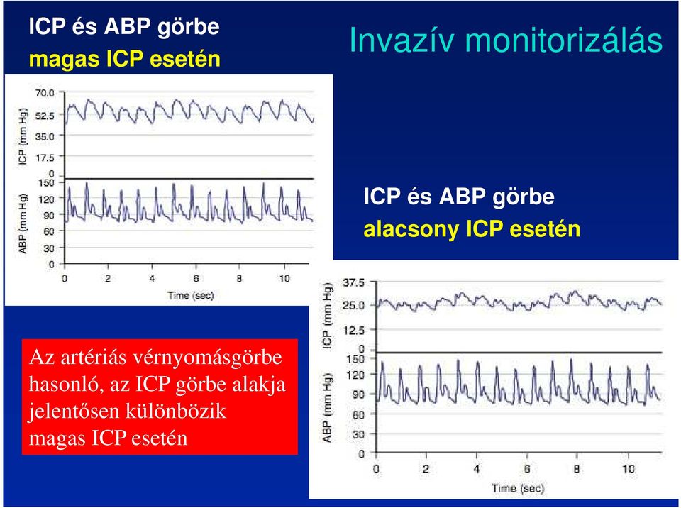 esetén Az artériás vérnyomásgörbe hasonló, az