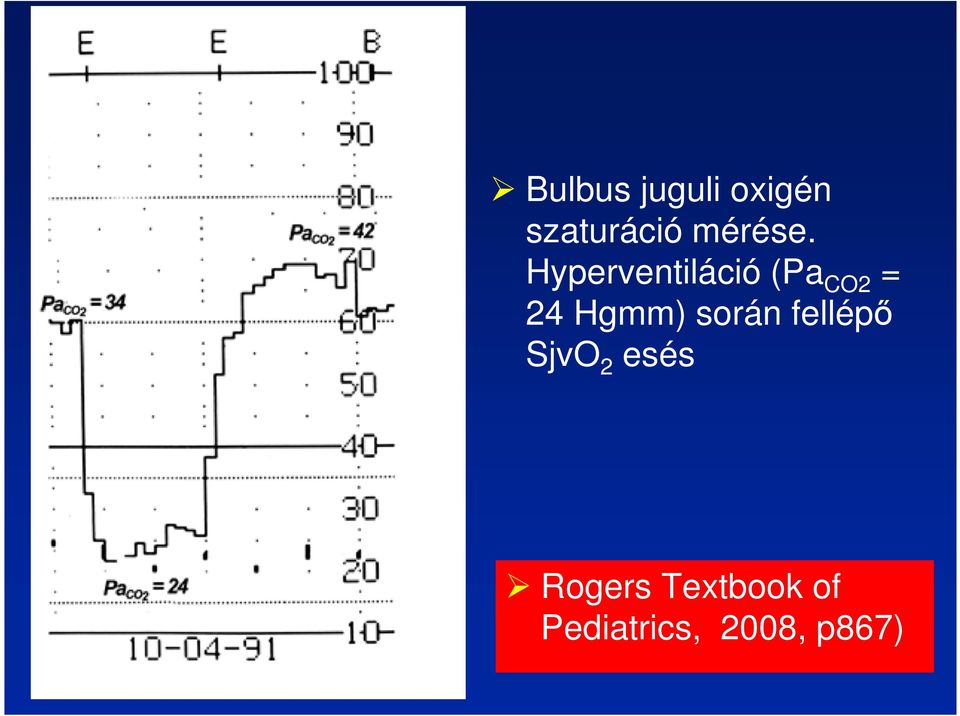 Hyperventiláció (Pa CO2 = 24 Hgmm)