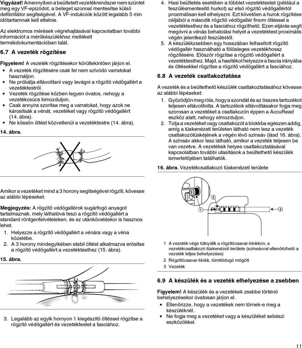 7 A vezeték rögzítése Figyelem! A vezeték rögzítésekor körültekintően járjon el. A vezeték rögzítésére csak fel nem szívódó varratokat használjon.