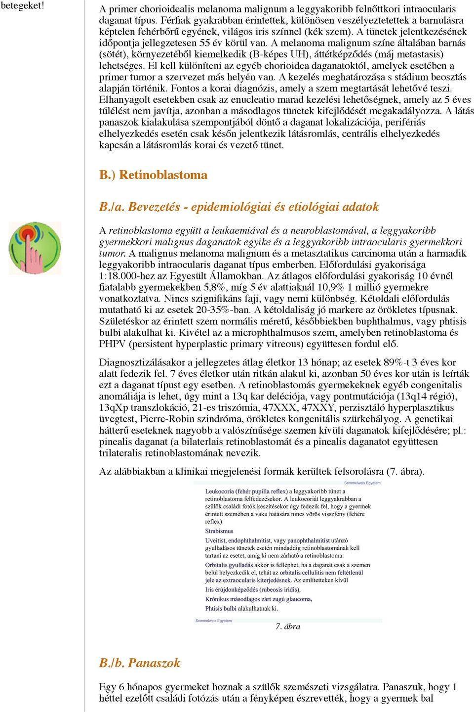 A melanoma malignum színe általában barnás (sötét), környezetéből kiemelkedik (B-képes UH), áttétképződés (máj metastasis) lehetséges.