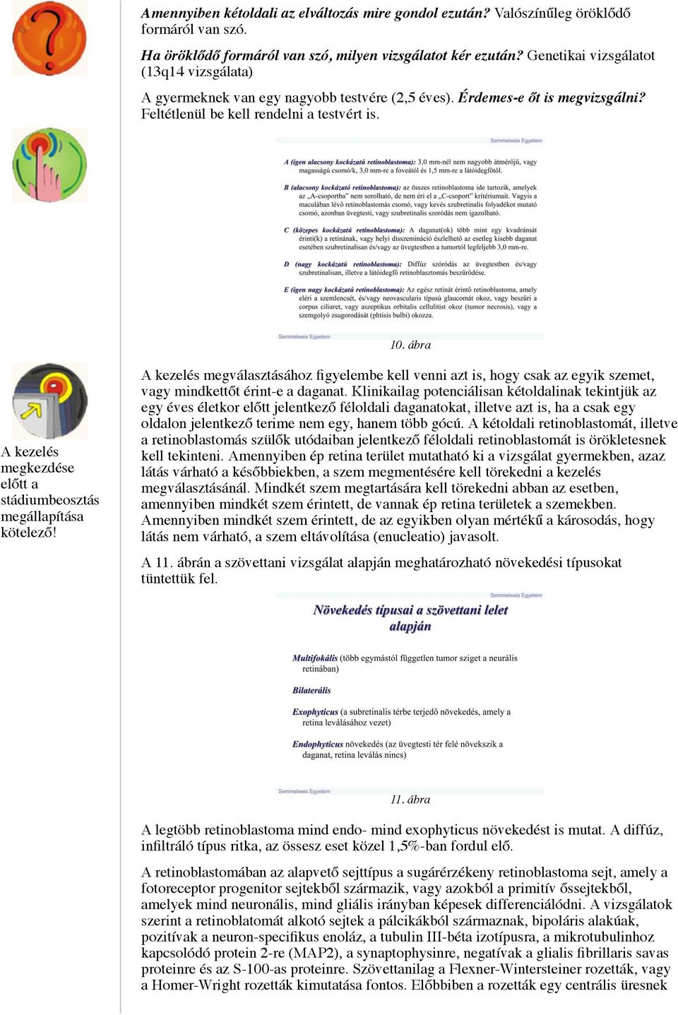 ábra A kezelés megkezdése előtt a stádiumbeosztás megállapítása kötelező! A kezelés megválasztásához figyelembe kell venni azt is, hogy csak az egyik szemet, vagy mindkettőt érint-e a daganat.