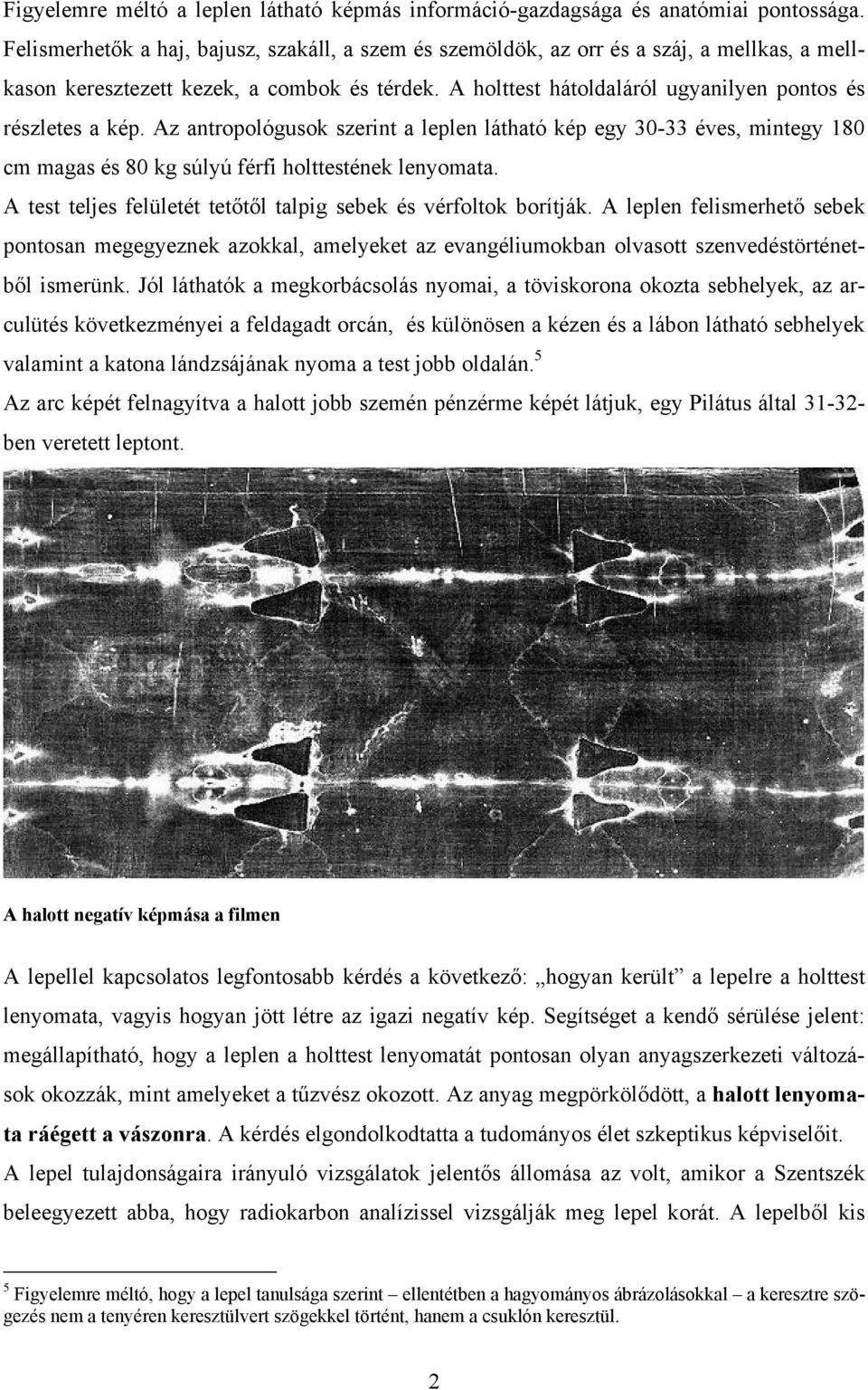 A holttest hátoldaláról ugyanilyen pontos és részletes a kép. Az antropológusok szerint a leplen látható kép egy 30-33 éves, mintegy 180 cm magas és 80 kg súlyú férfi holttestének lenyomata.