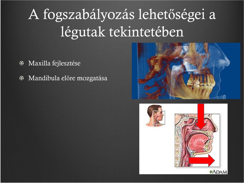 tekintetében Maxilla