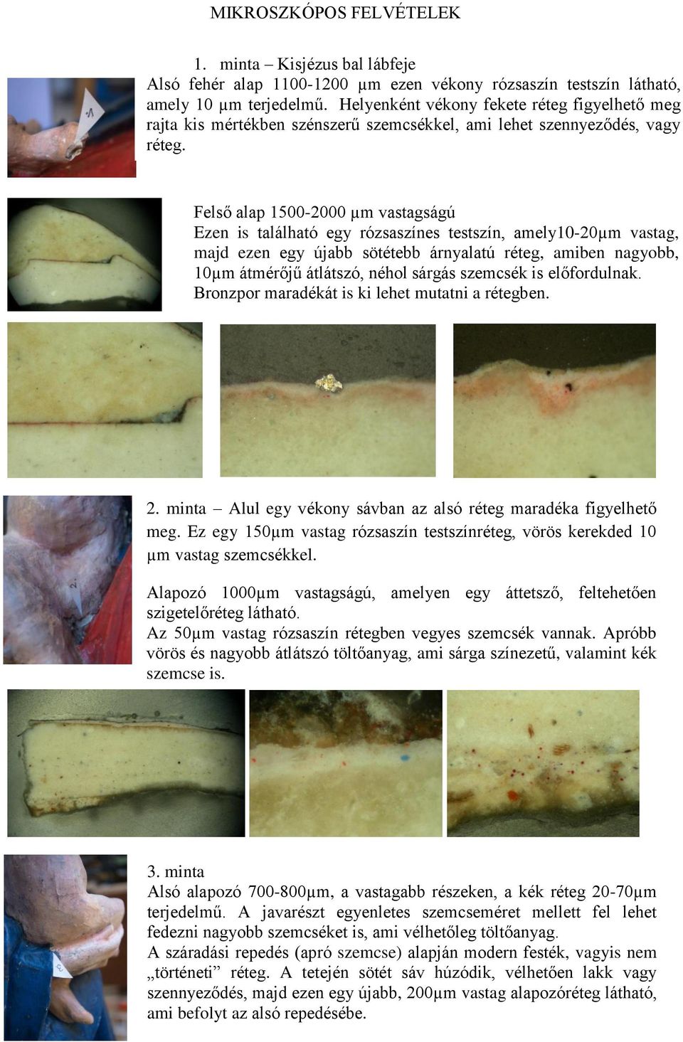 Felső alap 1500-2000 µm vastagságú Ezen is található egy rózsaszínes testszín, amely10-20µm vastag, majd ezen egy újabb sötétebb árnyalatú réteg, amiben nagyobb, 10µm átmérőjű átlátszó, néhol sárgás