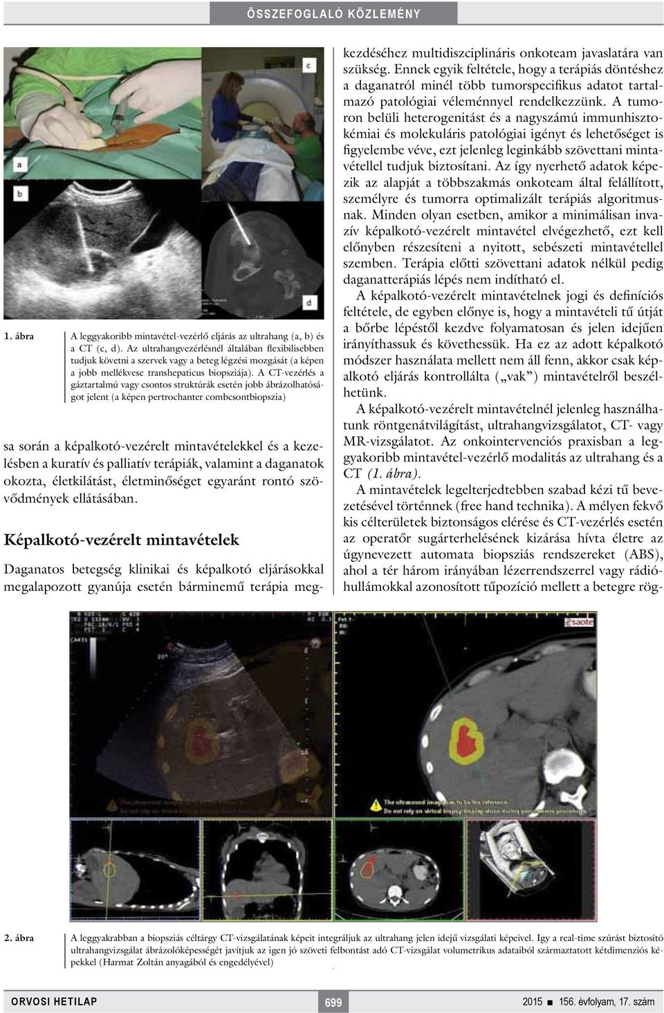 A CT-vezérlés a gáztartalmú vagy csontos struktúrák esetén jobb ábrázolhatóságot jelent (a képen pertrochanter combcsontbiopszia) sa során a képalkotó-vezérelt mintavételekkel és a kezelésben a