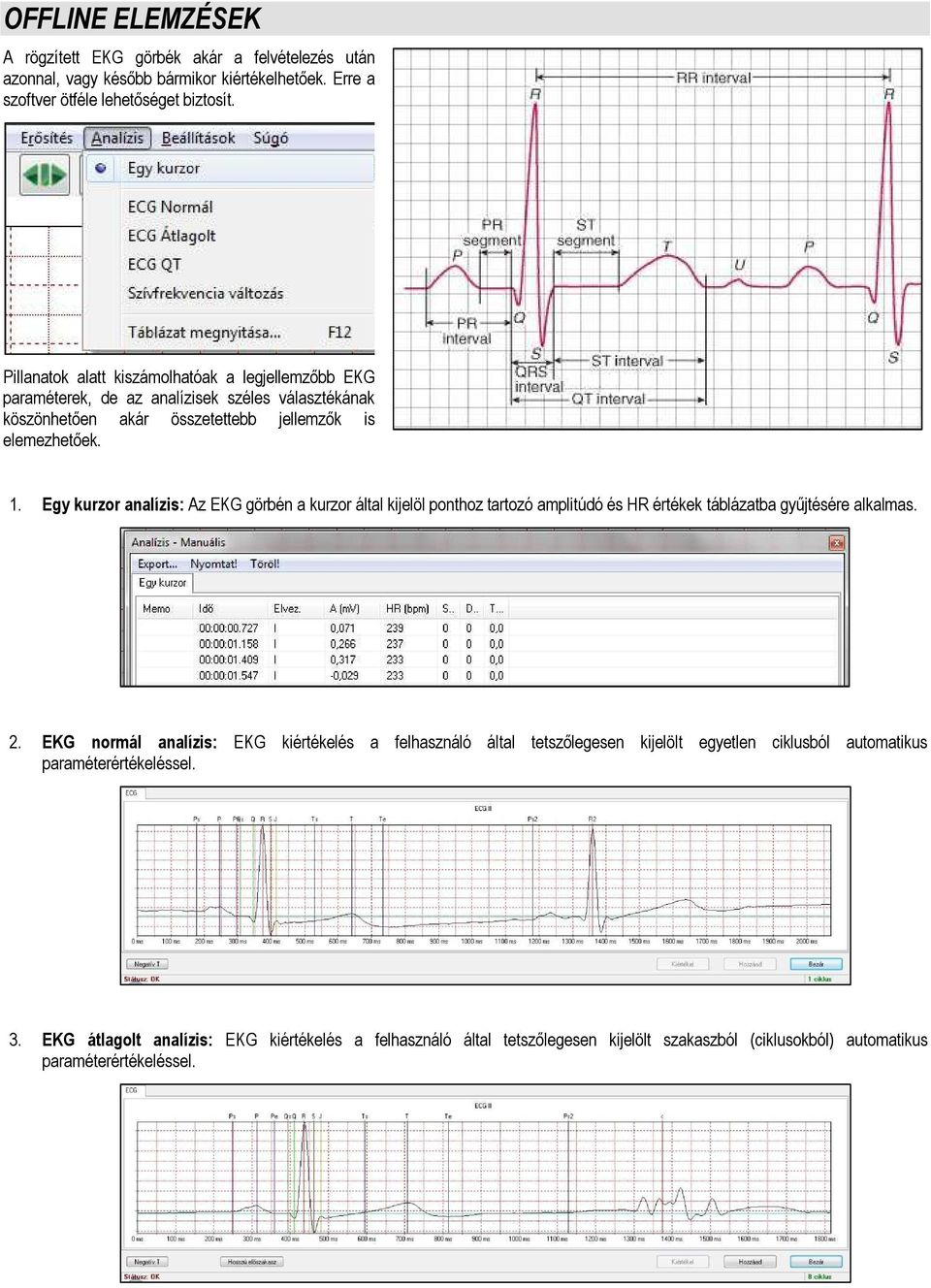 Egy kurzor analízis: Az EKG görbén a kurzor által kijelöl ponthoz tartozó amplitúdó és HR értékek táblázatba gyűjtésére alkalmas. 2.