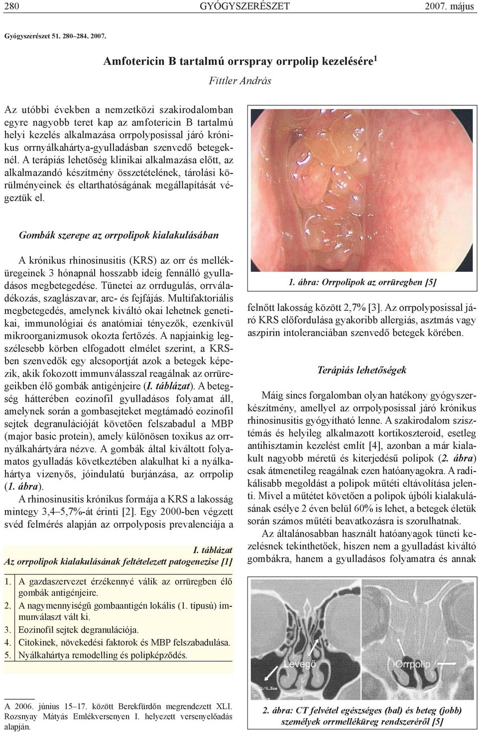 Amfotericin B tartalmú orrspray orrpolip kezelésére 1 Az utóbbi években a nemzetközi szakirodalomban egyre nagyobb teret kap az amfotericin B tartalmú helyi kezelés alkalmazása orrpolyposissal járó