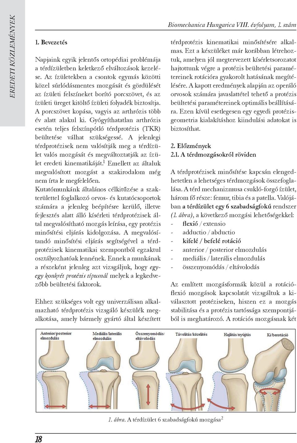 A porcszövet kopása, vagyis az arthrózis több év alatt alakul ki. Gyógyíthatatlan arthrózis esetén teljes felszínpótló térdprotézis (TKR) beültetése válhat szükségessé.