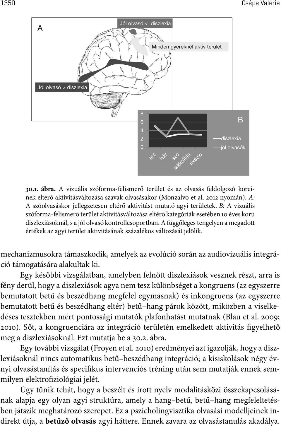 A: A szóolvasáskor jellegzetesen eltérő aktivitást mutató agyi területek.