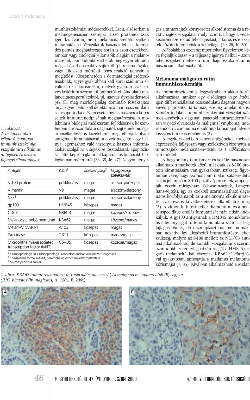 magas alacsony/közepes Vimentin V9 magas alacsony/alacsony NSE 3 poliklonális magas alacsony/alacsony gp100 HM45 közepes magas CD63 NKI/C3 magas közepes/közepes Melanocyta belsô membrán K62 magas