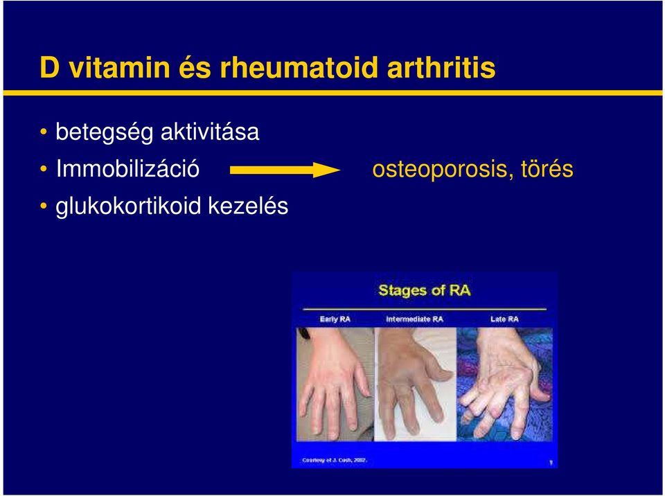 aktivitása Immobilizáció