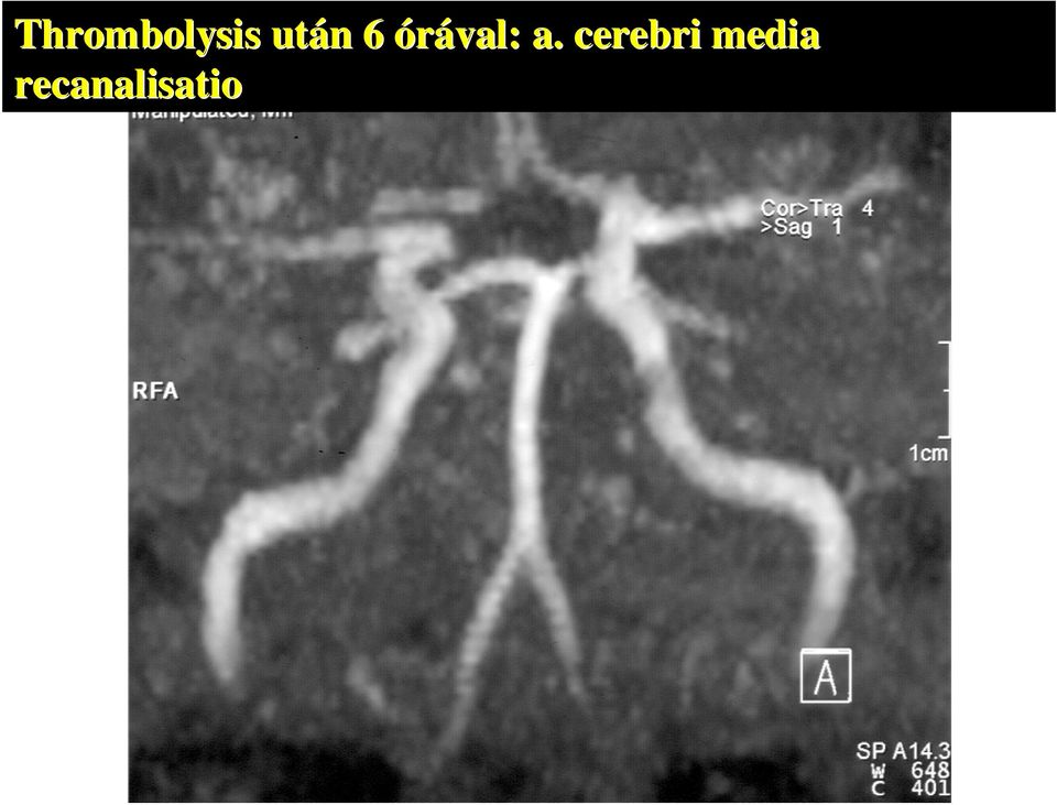 órával: a.