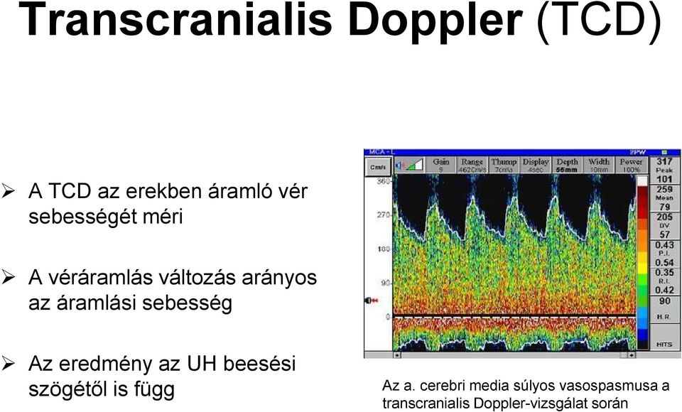 sebesség Az eredmény az UH beesési szögétől is függ Az a.