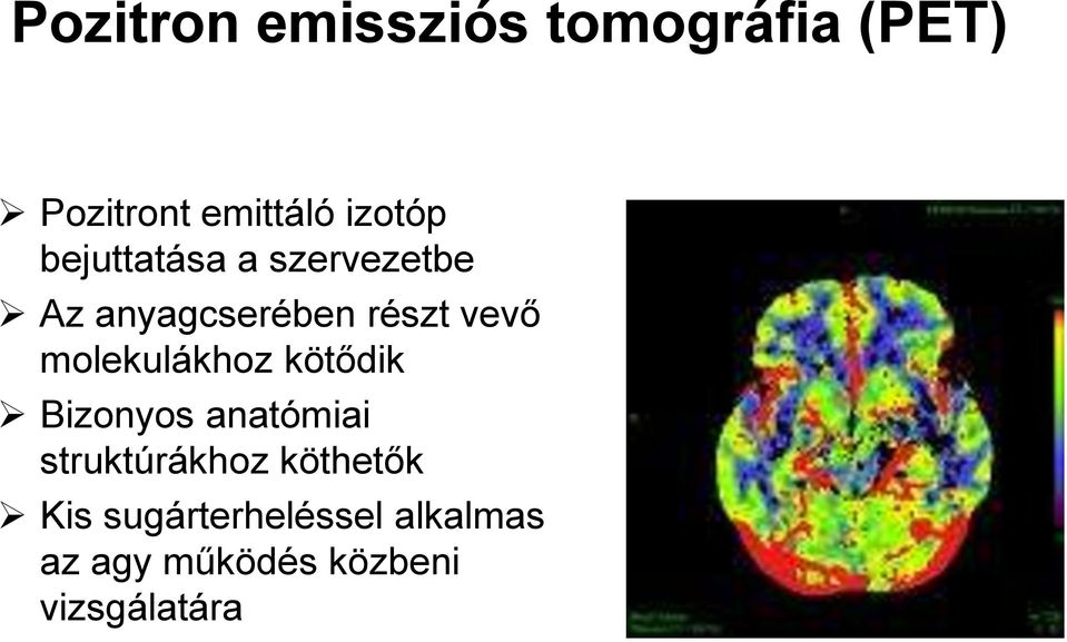 molekulákhoz kötődik Bizonyos anatómiai struktúrákhoz