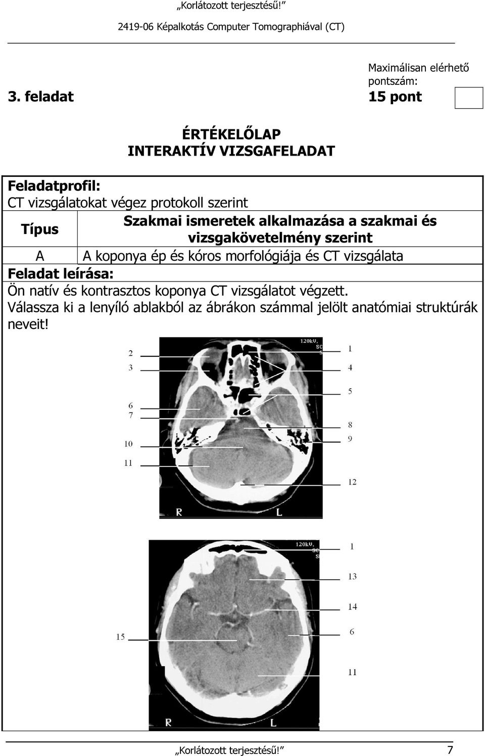 ismeretek alkalmazása a szakmai és Típus vizsgakövetelmény szerint A A koponya ép és kóros morfológiája és CT vizsgálata